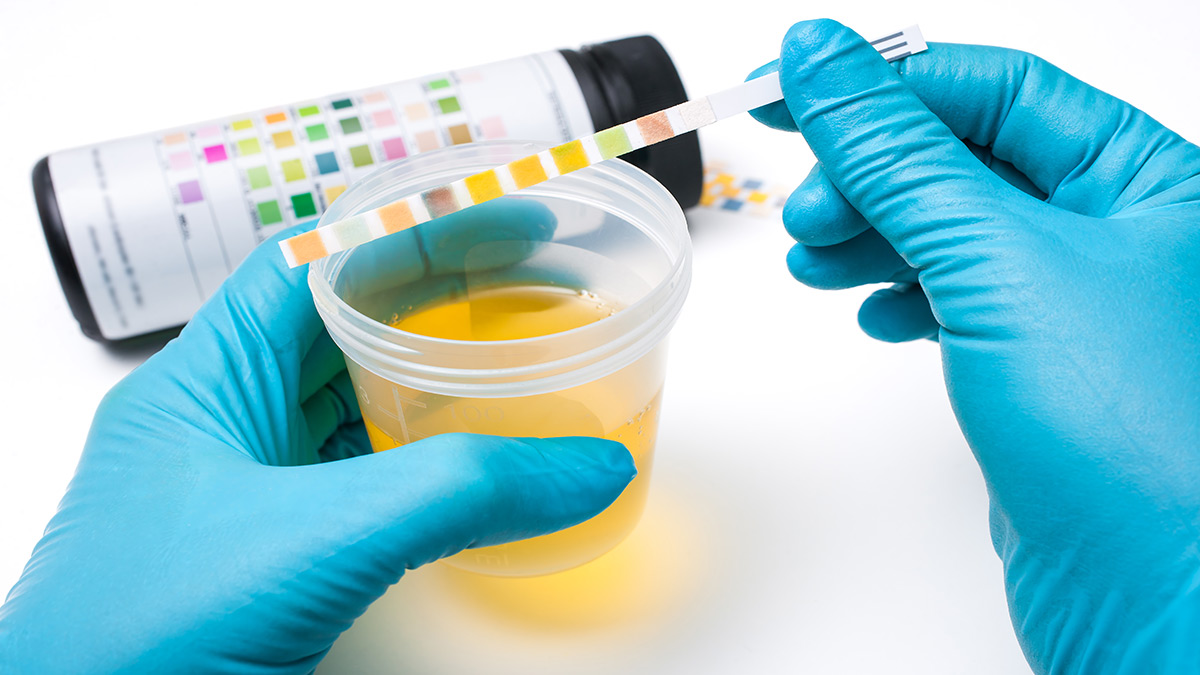 Image of Urine Drug Test