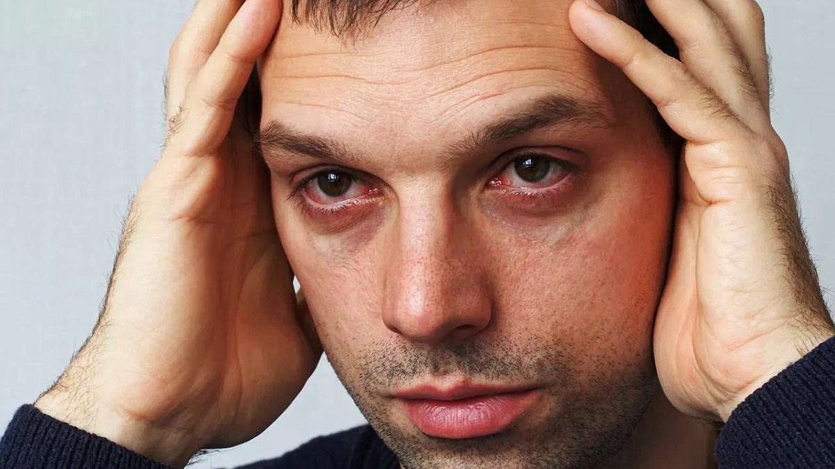 Image of A Man Holding His Head and Have Red Eyes