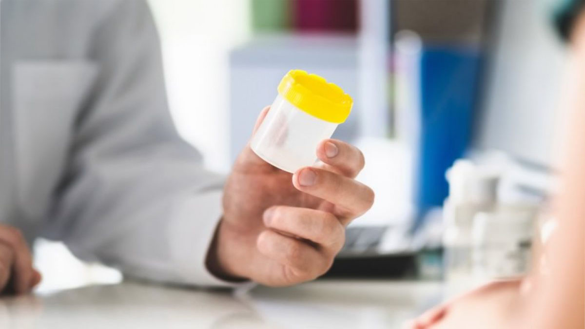 Image of Doctor handing over urine medical container