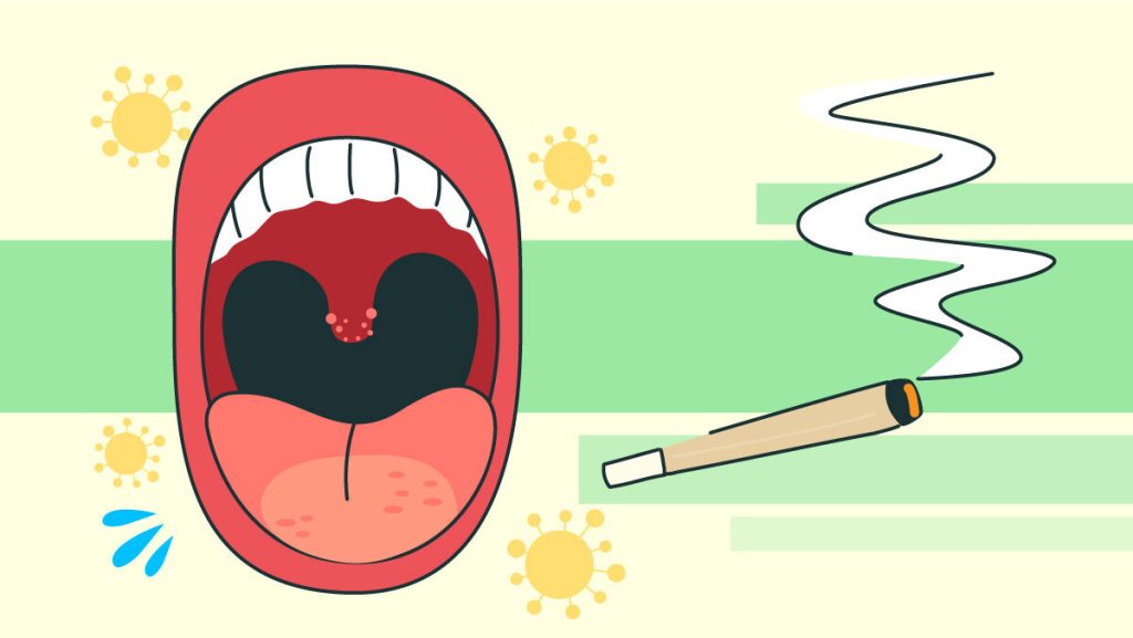 Sore Throat From Smoking Weed What's the Solution? Rolling Paper